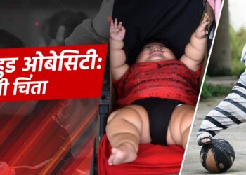 चाइल्डहुड ओबेसिटी: एक बढ़ती चिंता