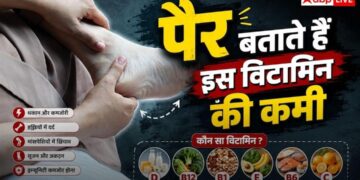 Vitamin B12 Deficiency: पैरों में इन लक्षणों के दिखने का मतलब विटामिन बी12 की कमी, तुरंत भागें डॉक्टर के पास